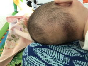 赤ちゃんの後頭部がはげてきても大丈夫 対策グッズもご紹介 ゆうまま育児ブログ